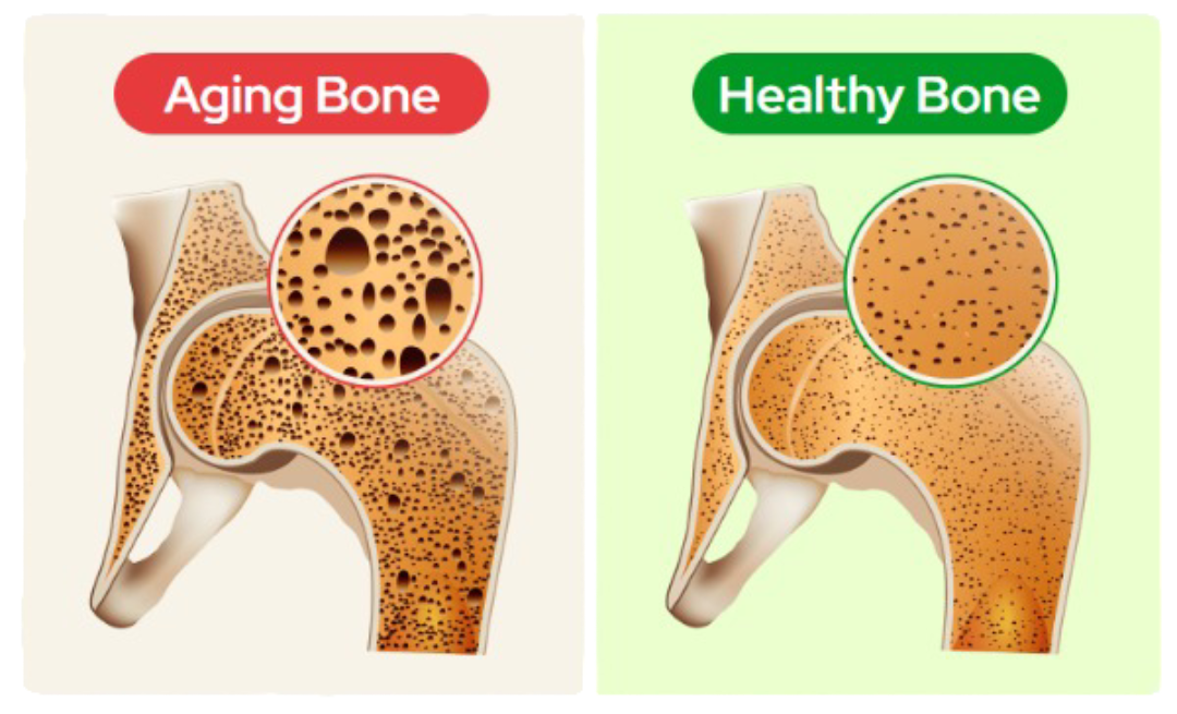 Biocal Bone Support Bones