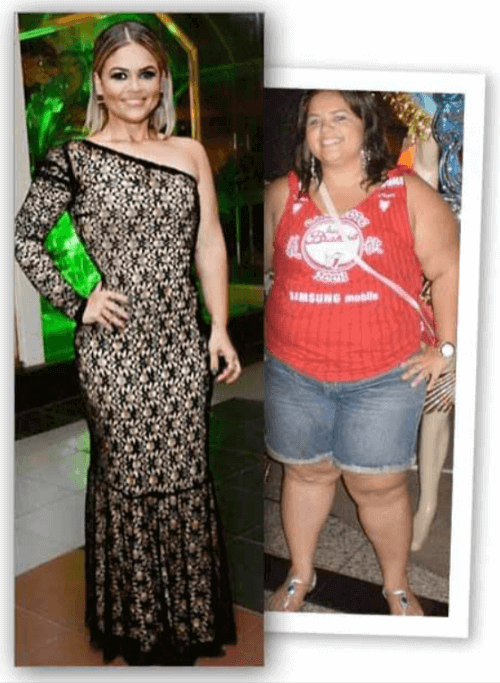 HydroLean XT Gold Weight Loss