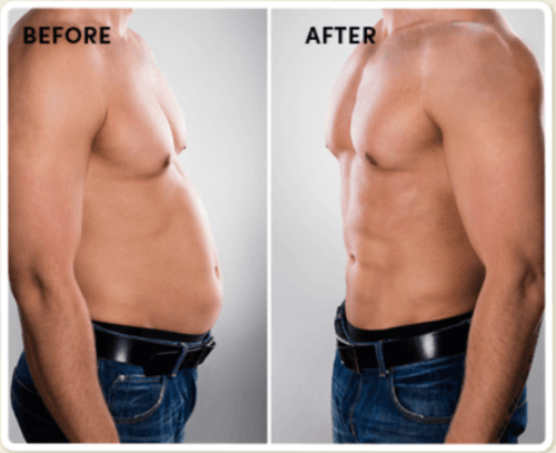 Smash It Slimming Shake Before And After